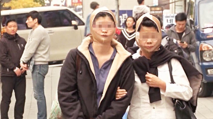 Plastic Surgery Patients Stuck In Airport As Faces Dont Match Passports World Of Buzz 1