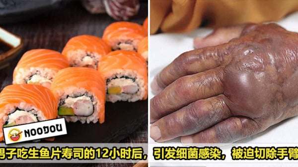 Raw Salmon Infection Featured 1