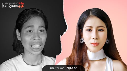 Cao Thị Lan Hành Trình Lột Xác 1