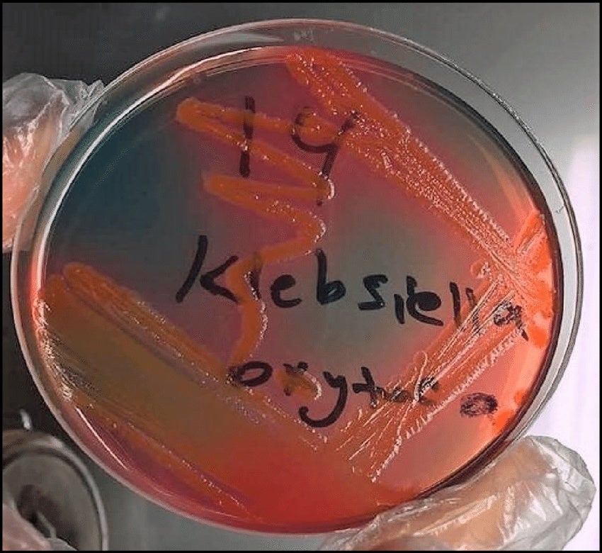 Growth Of Klebsiella Oxytoca On Cled Agar Plate This Is A Selective Differential