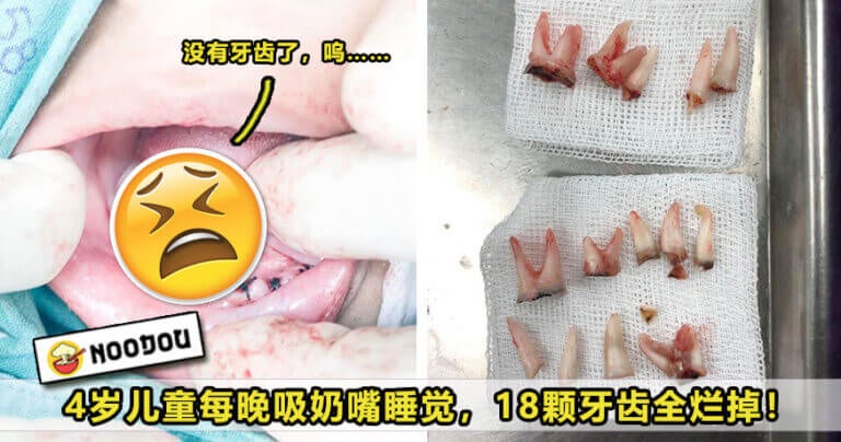 tooth 1 768x404 1