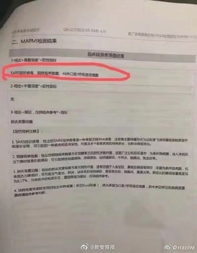 20200207Cpkk19E Wuhan Coronavirus Doctor Dies