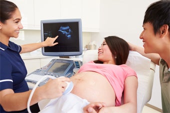 Fetal Ultrasound 340x226 1