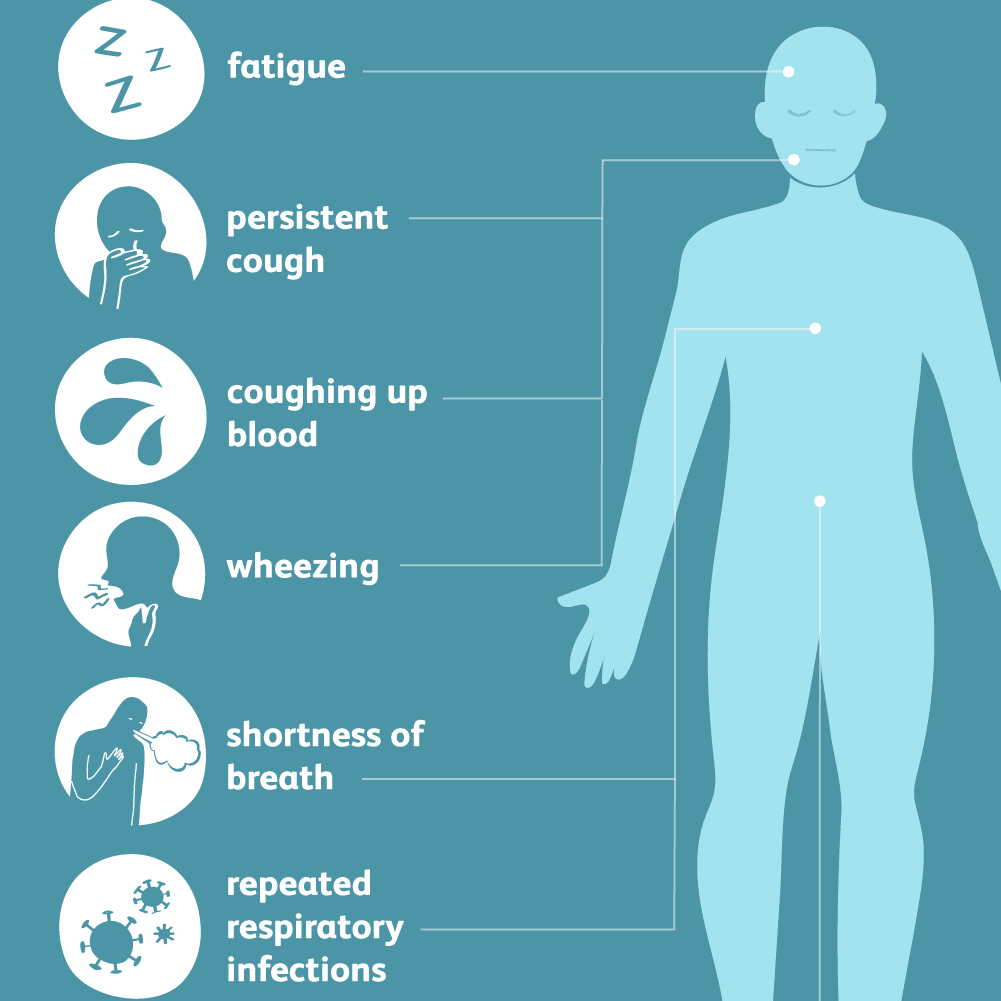 What Is Stage 3 Lung Cancer Life Expectancy 2249419 Final 5Bc3F4F2C9E77C0051303245