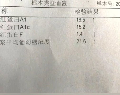 糖尿病检验单