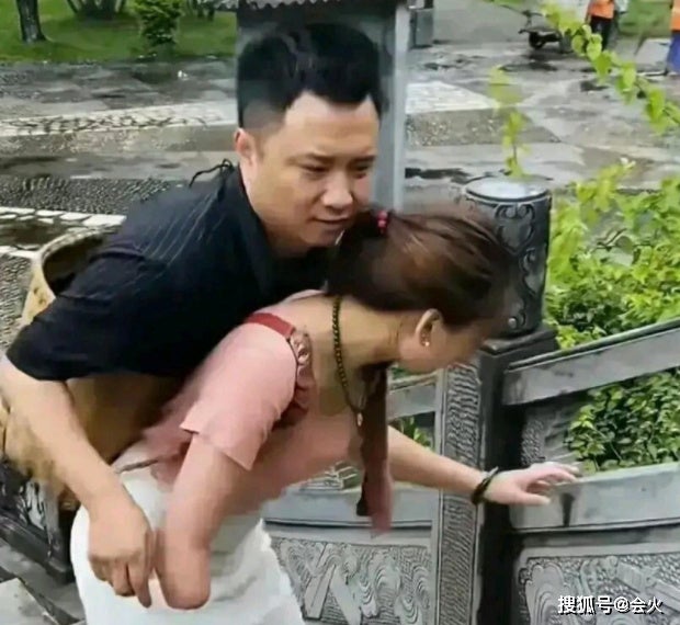 连体夫妻