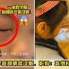 数学题眼睛过敏 Ft Image V2