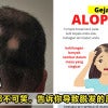 Alopecia Featured