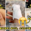 Bihun Stuck In Nail Featured 2