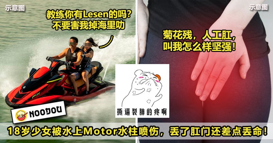 18岁少女被水上Motor水柱喷伤，丢肛门又差点丢命——最新版！