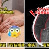 22岁女子按摩后四肢抽搐瘫痪，送院抢救捡回命！