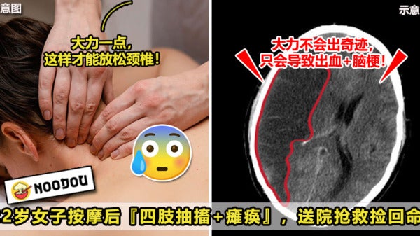 22岁女子按摩后四肢抽搐瘫痪，送院抢救捡回命！