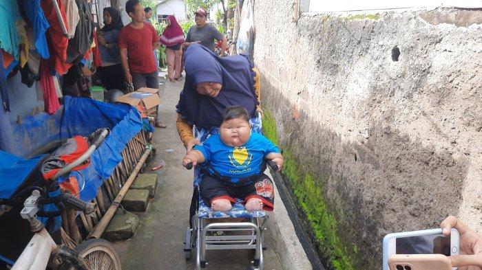 Bayi 16 bulan penderita obesitas bernama M Kenzi Alfaro di Bekasi