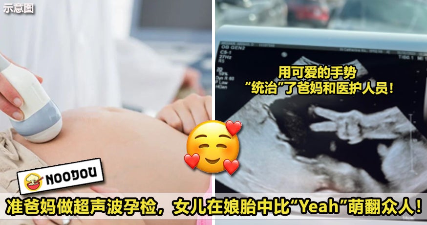 准爸妈做超声波孕检，女儿在娘胎中比Yeah萌翻众人！