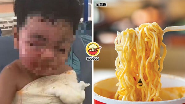 Cup Noodle Burn 2 Yo Baby Feature Image