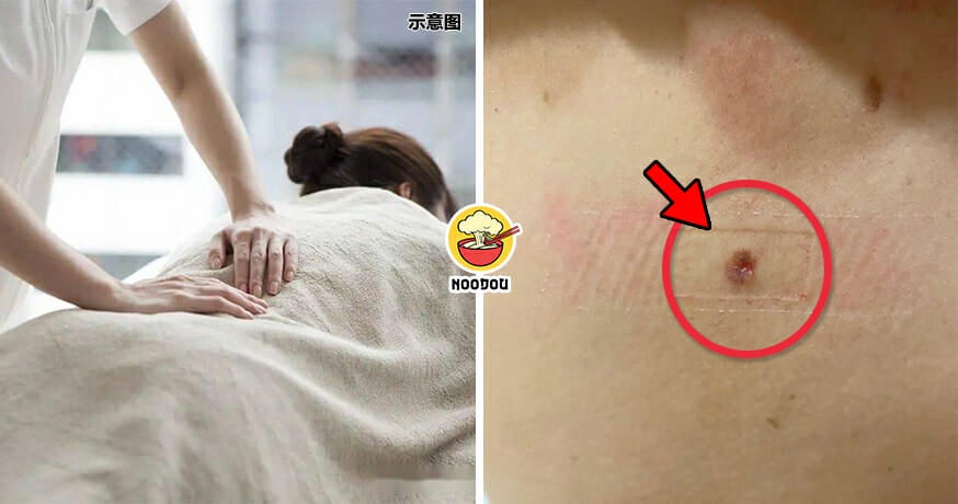 Massage Half Mole Ripped Off Feature Image