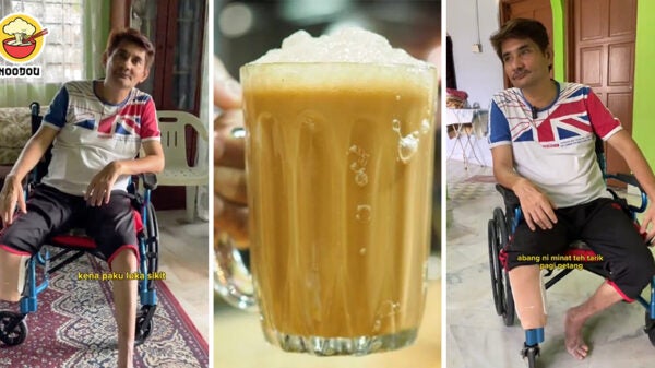 Teh Tarik Everyday Diabetes Leg Feature Image