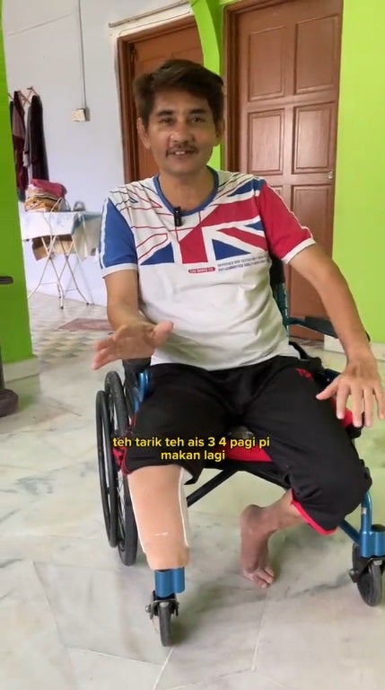 Ss 2 Man Drinks Teh Tarik Everyday Diabetes Lost His Leg