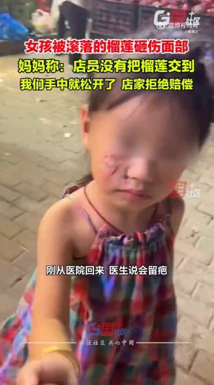 ss 5 durian hit little girl face injured