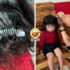 Daughter Hair Stuck Bomba Help Feature Image