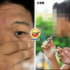 Student Vape Eye Rotan Feature Image