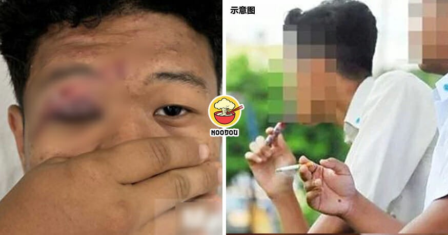 Student Vape Eye Rotan Feature Image