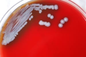 Burkholderia Pseudomallei On Blood Agar.tif