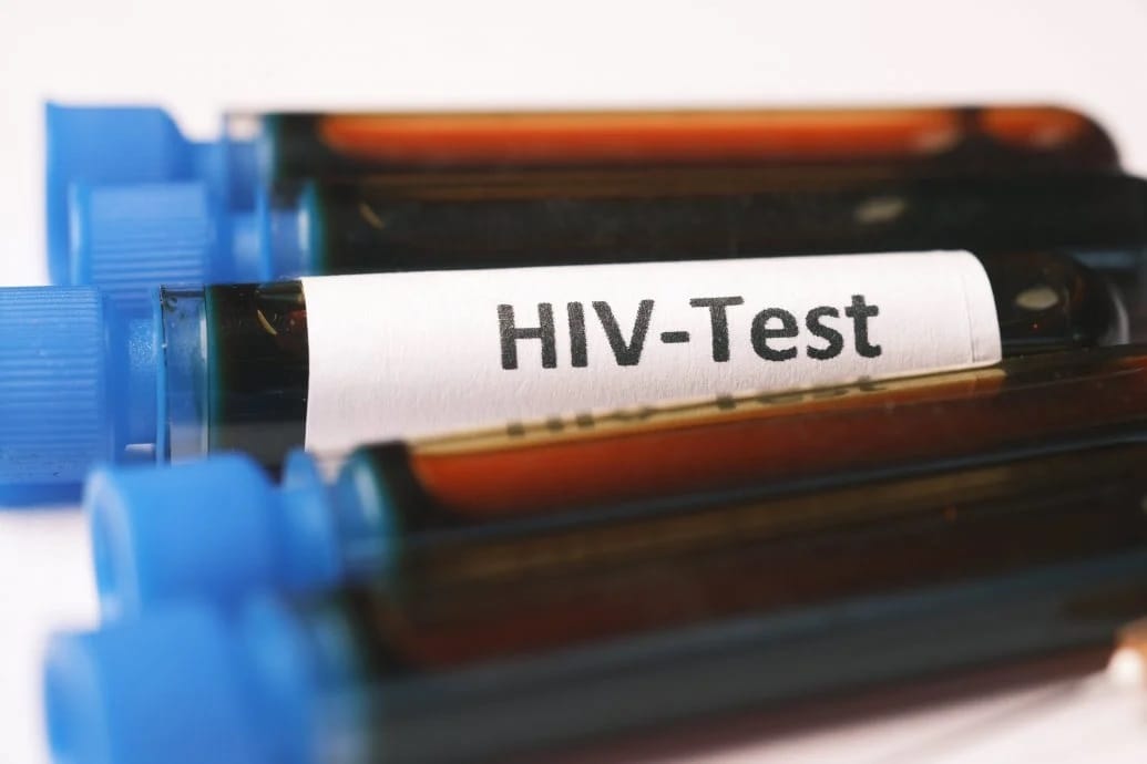 HIV test tubes