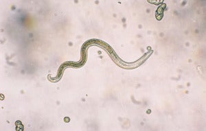 2019 0910 Roundworms Fig1B