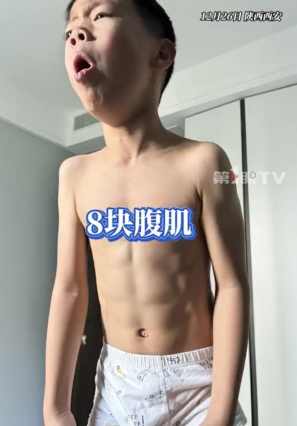 咳嗽咳出腹肌