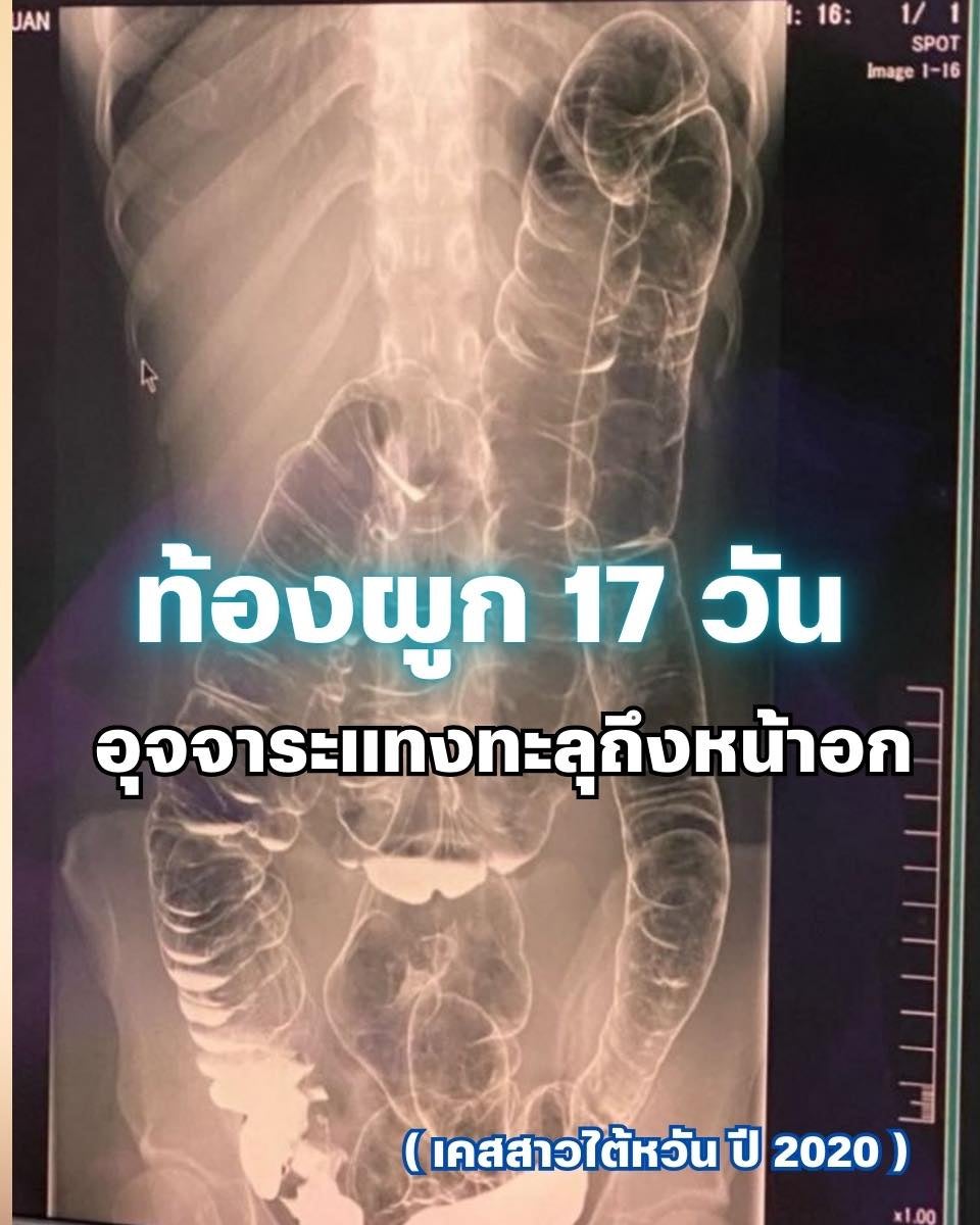 8a679a41 7183 4976 850e 2badbce77508
