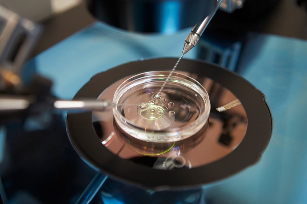 IVF fertilization in lab