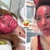 FT IMAGE red face
