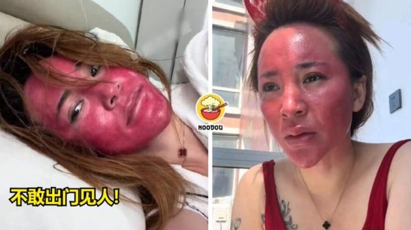 FT IMAGE red face