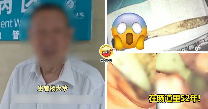 FT IMAGE toothbrush