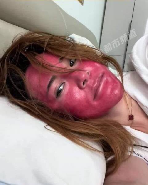 红脸