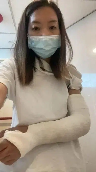 大马男子新加坡骑摩托车遇车祸昏迷20多天女友受伤