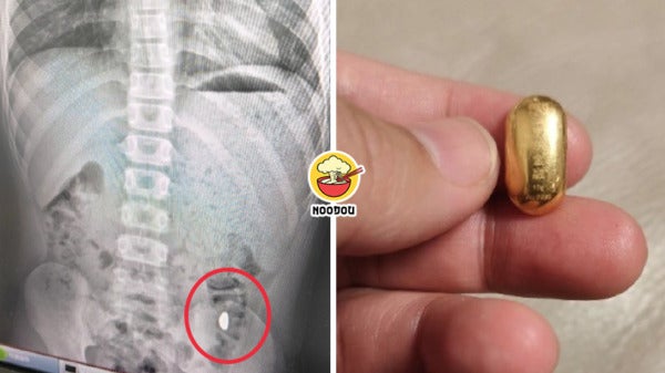 11YO Swallow Gold Ft Img