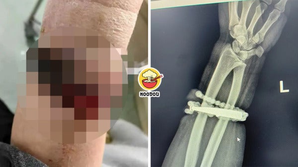 10 Years Bracelet Hand Ft Img