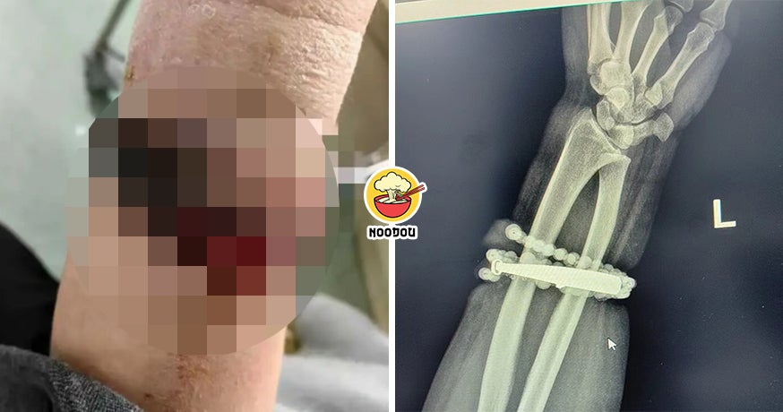 10 Years Bracelet Hand Ft Img