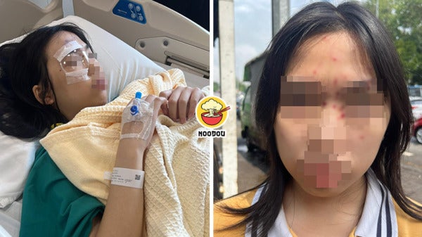 Science Experiment Eye Injured Ft Img