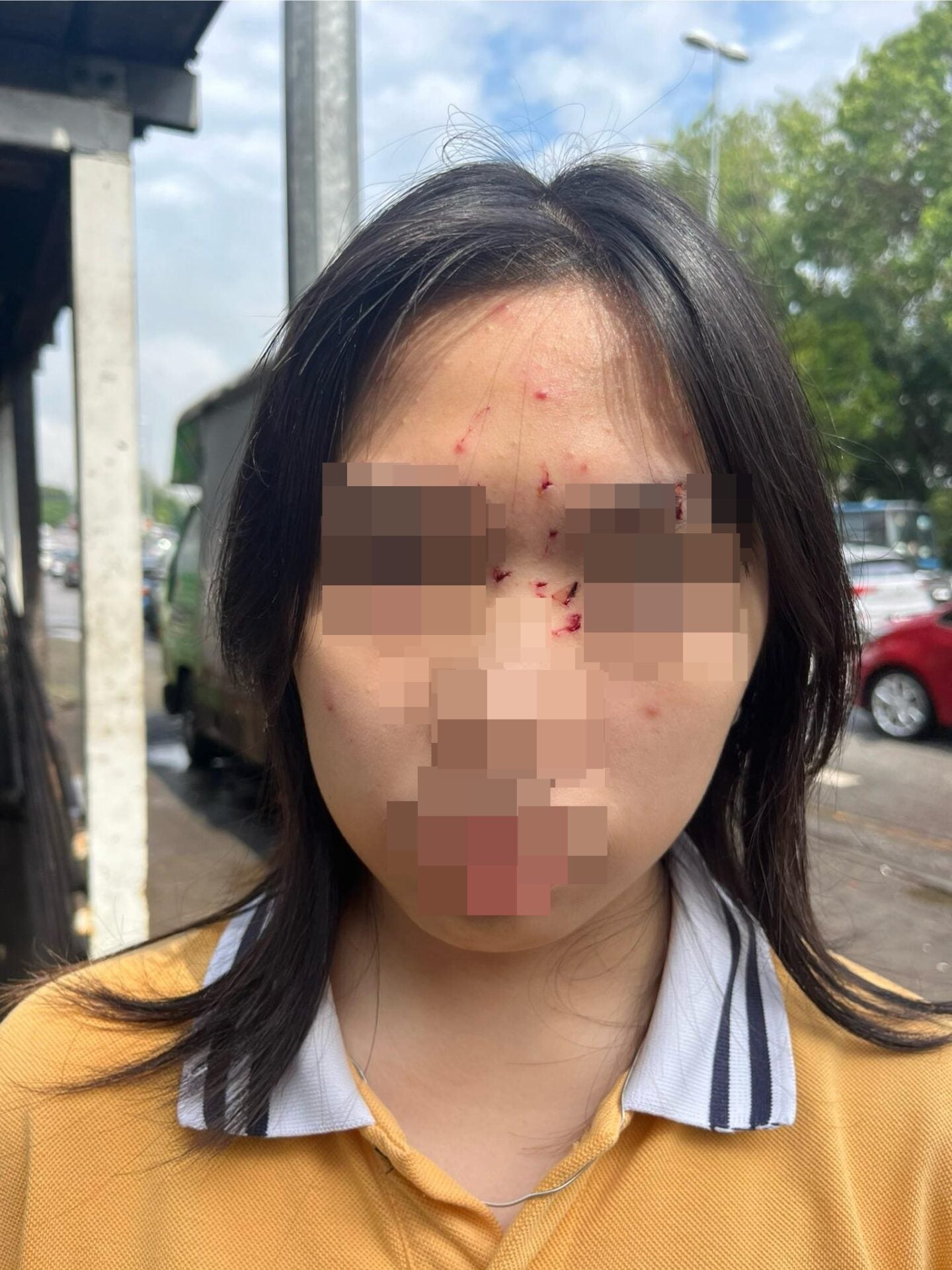 学校科学实验室爆炸事故眼睛受伤家长不满意校方解决方案 4