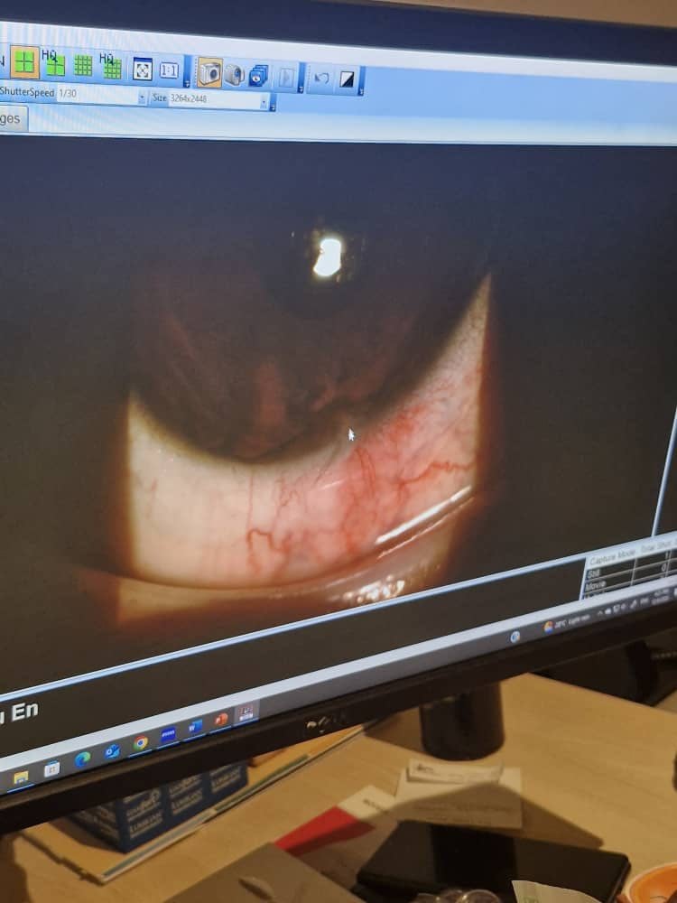 学校科学实验室爆炸事故眼睛受伤家长不满意校方解决方案 8