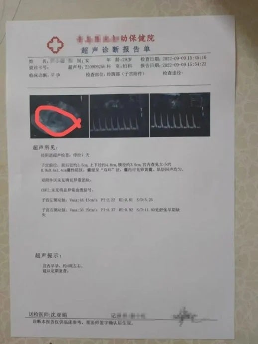 女子骗婚伪造超声波诊断报告假怀孕