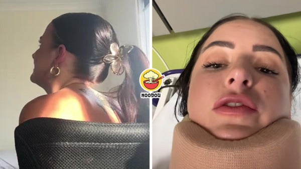 Claw Clip Head Neck Ft Img