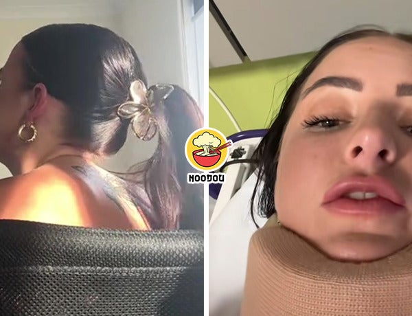 Claw Clip Head Neck Ft Img