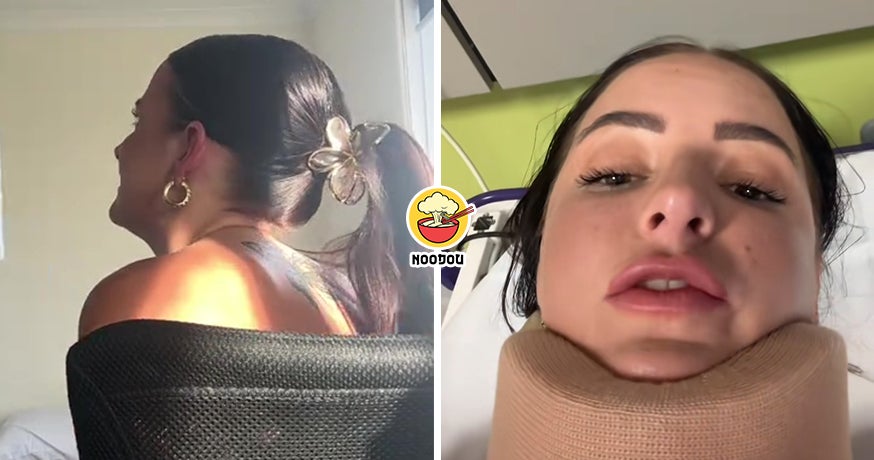 Claw Clip Head Neck Ft Img