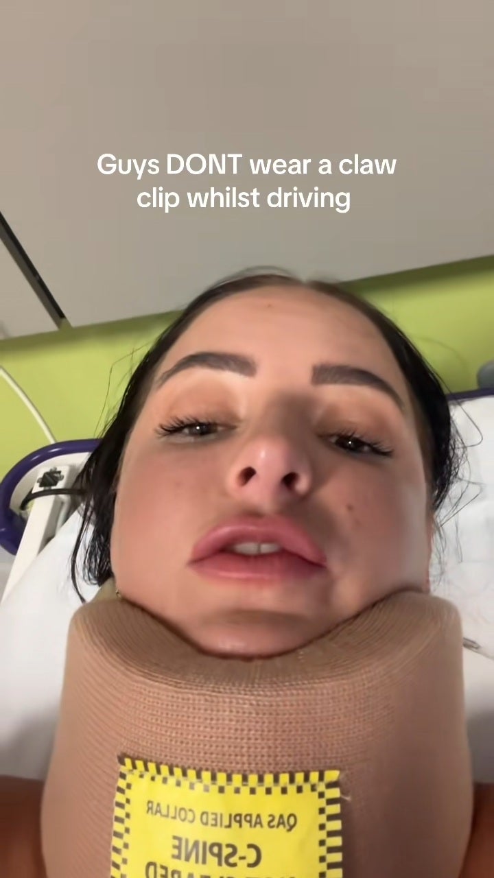 Woman Claw Clipi Car Accident Neck Head Concussion Whiplash