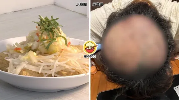 Stinky Toufu Pluck Hair Ft Img