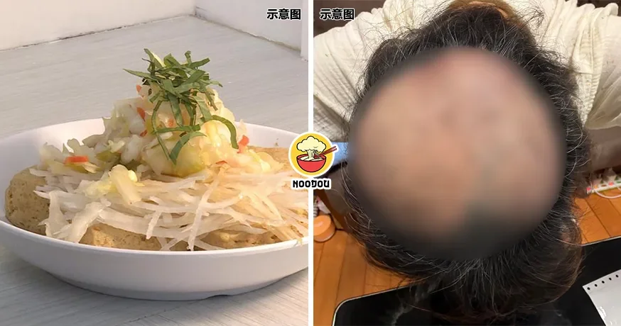 Stinky Toufu Pluck Hair Ft Img